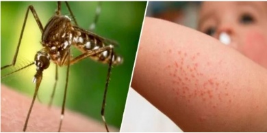 3 إصابات بينها خطيرة بـ"حمى النيل" في تل أبيب