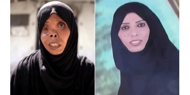 لا مأوى ولا عمل وتشوهات جسدية.. هكذا حولت الحرب الإسرائيلية الحياة في غزة