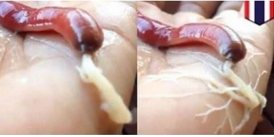 معلومات مرعبة عن الدودة الشريطية.. تجنبوا مسبباتها!