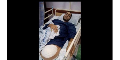 خظأ طبي فادح يكلف الشاب غالب من نابلس رجله التي بترت