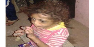 يعذب طفلته حرقاً بسبب تناولها لطعام أخيها