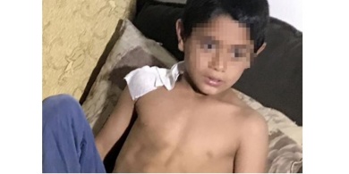 مُروع: موظفة "ماكدونالدز" بتركيا تلقي الماء المغلي على طفل سوري