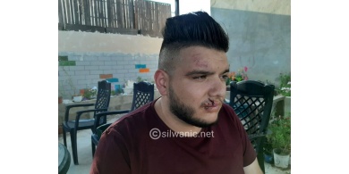 صور : مستوطن يطلق كلبه على سائق حافلة مقدسي !