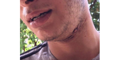 نجا بأعجوبة... محمد يروي قصة الإعتداء عليه من قِبل المستوطن أمس