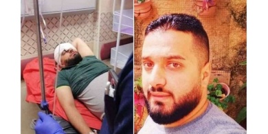 أسير محرر يفقد عينه برصاص الاحتلال أمس في سبسطية