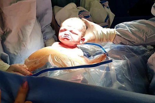 تعبيرات غاضبة تعلو وجه رضيعة عقب ولادتها بثوان