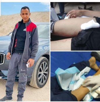 اصابة شابين بالرصاص الحي واعتقال آخر في مخيم عقبة جبر بأريحا