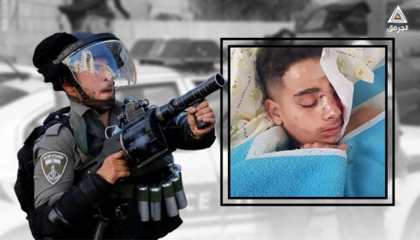 باسل أبو العلا.. طفلٌ فلسطيني قلعت الشرطة &ldquo;الإسرائيلية&rdquo; عينه