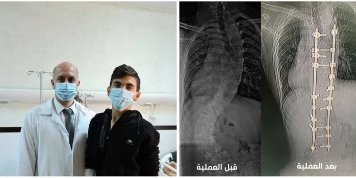 الفتى أُبي: "أزاح الأطباءُ حِملاً كبيراً عن ظهري"..(نجاح عملية خطيرة في مجمع فلسطين الطبي لتصحيح العمود الفقري)