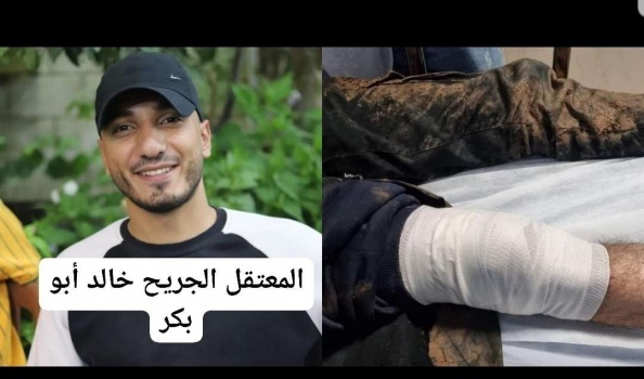 إصابة شابين برصاص الإحتلال جنوب جنين
