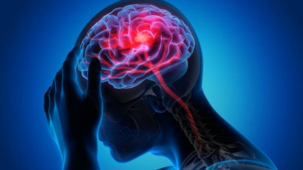 يجب ألا تتجاهلها.. علامات تدل على الإصابة بسكتة دماغية صغيرة