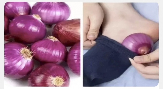 ما هي فوائد وضع شرائح البصل في جواربنا ليلاً