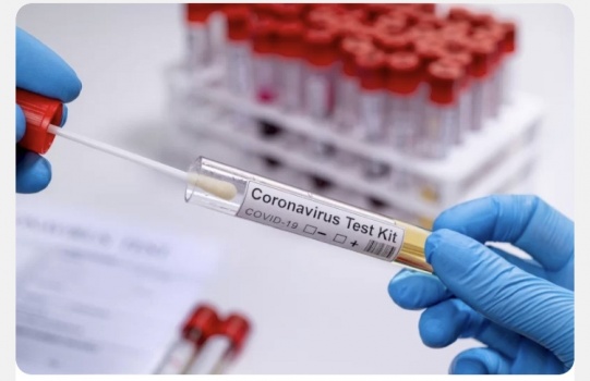 بعد أن حصد أرواح الملايين- هل أصبحت نهاية فيروس كورونا قريبة؟