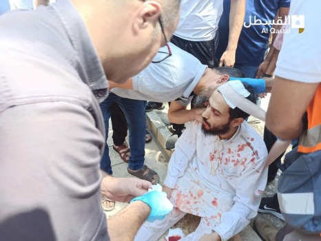إصابة 8 مواطنين خلال اعتداء الاحتلال على المصلين عند باب الأسباط بالقدس