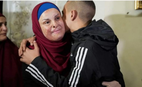 المحررة إسراء جعابيص: نخجل أن نفرح وفلسطين كلها جريحة