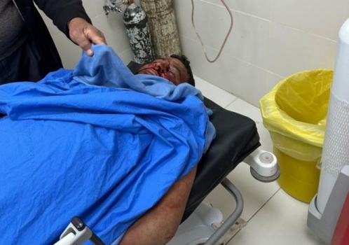 استشهاد شاب وإصابة شقيقه خالد بجروح حرجة برصاص مستوطنين في مسافر يطا