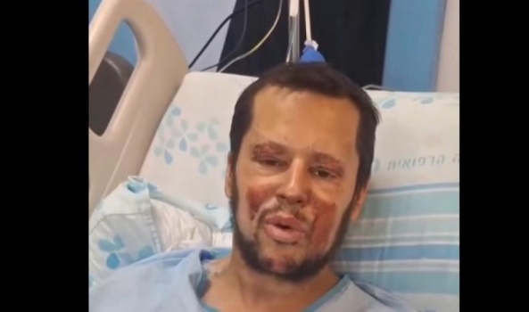 "بعضُ ثأر غزة يُسترد في جنوب لبنان"… "بوعز تمام" مرتكب جرائم الحرب في جباليا تشوّهه كورنيت حزب الله