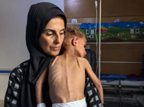466 وفاة بالتجويع في غزة منذ 2024.. بينهم 157 طفلا