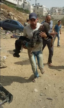 صور / اصابة طفل في حادث وقع بالخليل