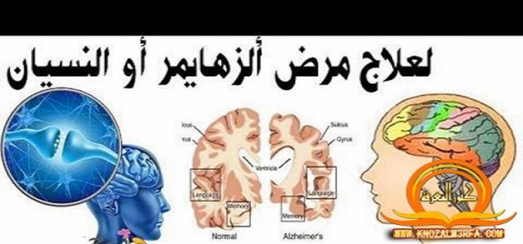 سورة في القرآن تقضي على مشكلة النسيان والزهايمر