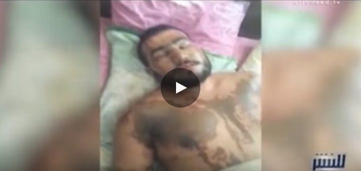 فيديو | اجبر زوجته على ممارسة الدعارة لتصاب بـ "الايدز" فانتقمت منه
