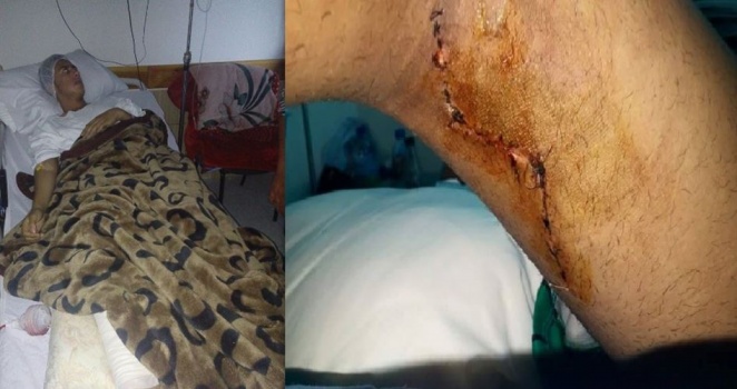 فتى جريح ببيت لحم لم يعرف النوم منذ 17 يوماً بسبب الألم