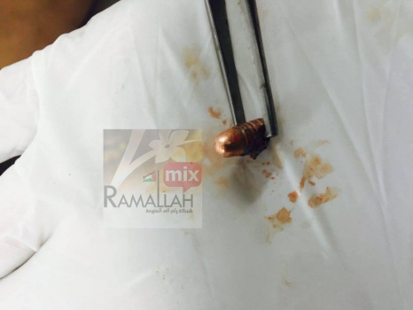 بالفيديو والصور : رصاصُ "الدِريل" ....للقتل فقط