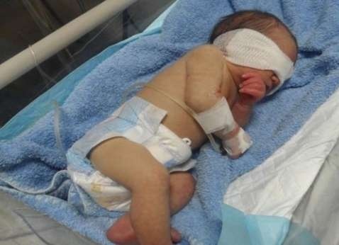 مات سريريا ً..الشرطة تحقق في ظروف إصابة طفل داخل حضانة في جنين