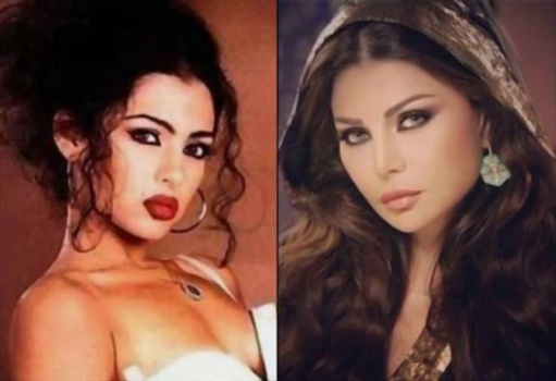 صور لا تُصدّق: هكذا أصبحت وجوه 6 من اشهر الفنانات العربيّات بسبب عمليات التجميل!