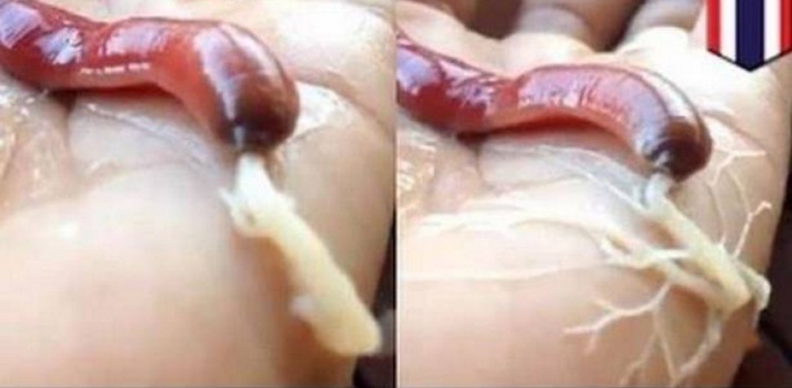 معلومات مرعبة عن الدودة الشريطية.. تجنبوا مسبباتها!