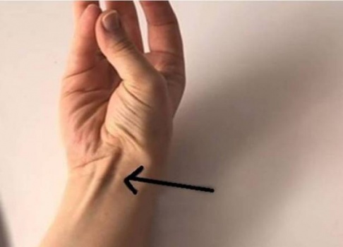 هل يبرز العرق من معصمك بهذا الشكل؟ إليكِ ما يعنيه ذلك!!