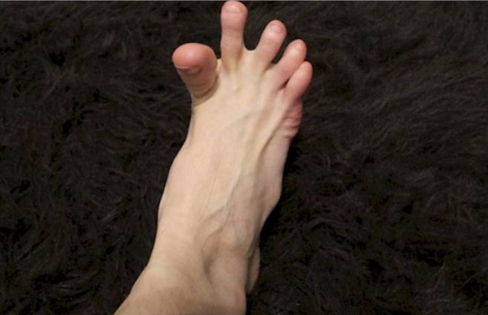 لهذا السبب تصابون بتشنجات مفاجئة في أقدامكم!!