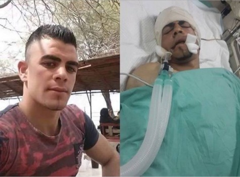 جمال دويكات ما زال حيا .. ولكن!