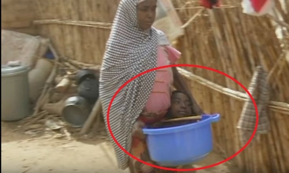 بالفيديو | حالة غريبة..شابة تعيش في وعاء بلاستيكي!