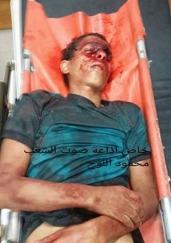 استشهاد شاب برصاص الاحتلال في قطاع غزة (صورة)