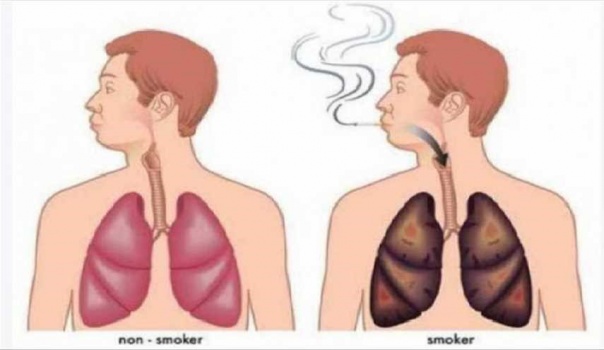 أفضل مشروب طبيعي يطهّر الرئتين من آثار التدخين!؟