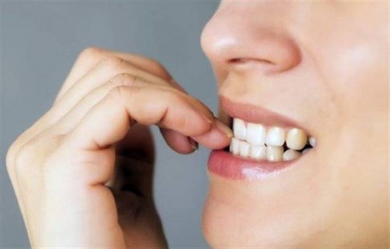 لماذا نقضم أظافرنا؟ 4 أشياء تفسر حدوث هذه العادة