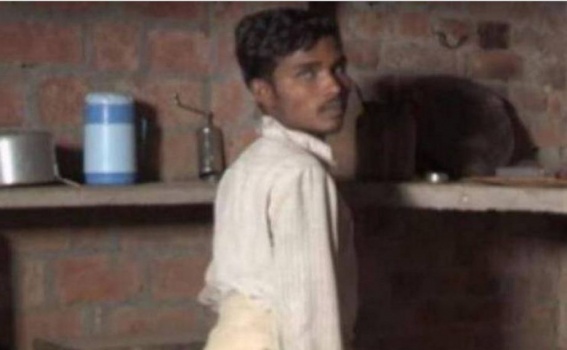 صورة| أصيب بتشوه خلقي فوُلد بأربع أرجل!