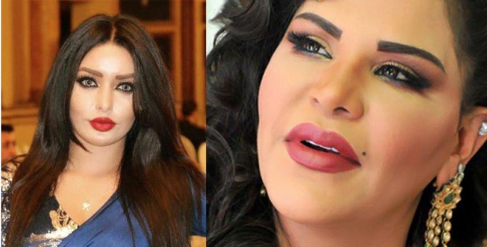 وصفتها بـ”ملكة البقر”.. أحلام تكتفي برد عابر على متسابقة “أراب آيدول” الجزائرية كاميليا ورد