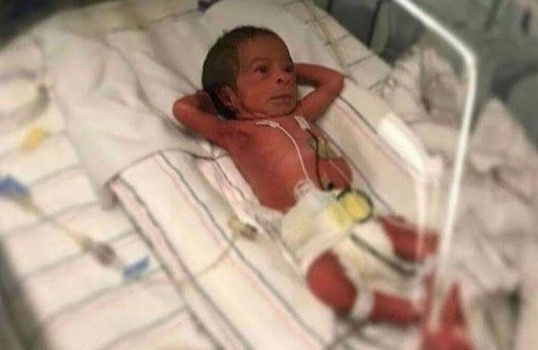 ماذا علق نشطاء التواصل الاجتماعي على صورة رضيع ولد في أحد مشافي غزة؟