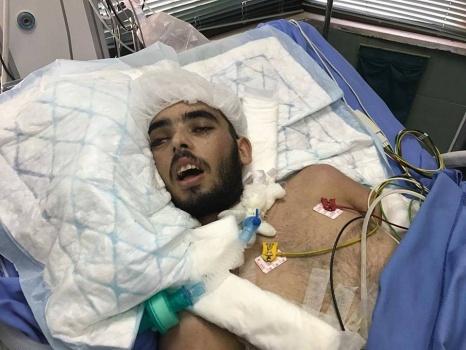 وفاة شاب من بلدة ميثلون جنوب جنين متأثرا بجروحه في حادث سير