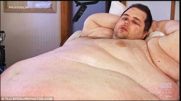 بالصور.. كيف وصل وزن هذا الرجل إلى 380 كيلوغراماً؟