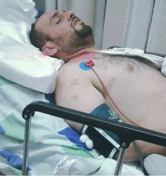 إصابة عامل من قباطية جنوب جنين أثناء عمله داخل اراضي ال48