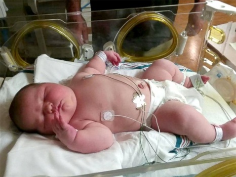 بالصور.. أميركية تنجب أضخم مولودة في العالم