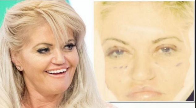 من هي الممثلة التي حولتها عمليات التجميل إلى بلهاء؟