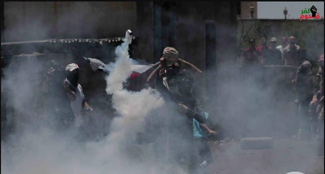 اصابة فتى برصاص الاحتلال في كفر قدوم