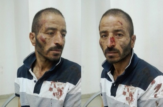 الاحتلال يعتدي بالضرب المبرح على مقدسي قبل اعتقاله
