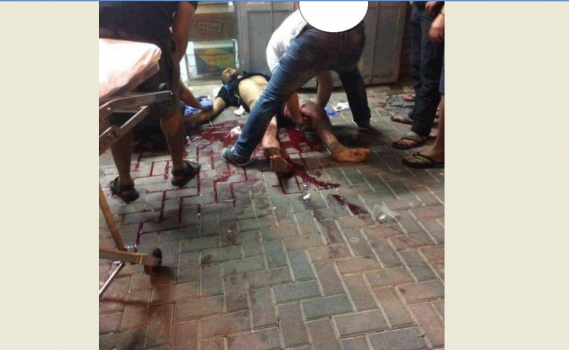 اصابة خطيرة لعامل من قلقيلية برصاص مجهولين داخل أراضي الــ48