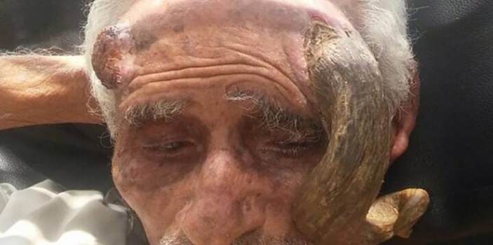 فيديو| هل تذكرون المعمِّر صاحب 'القرن'..هكذا تسبّبوا بقتله بوحشية لا توصف!