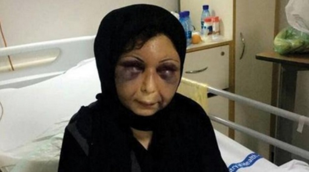 شاهد بالفيديو.. المعنفة السورية زهراء تكشف حقائق طليقها المروعة